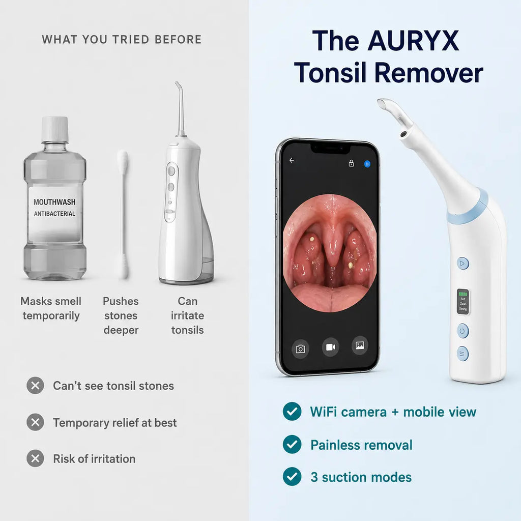 AURYX Tonsil Stone Remover with Camera